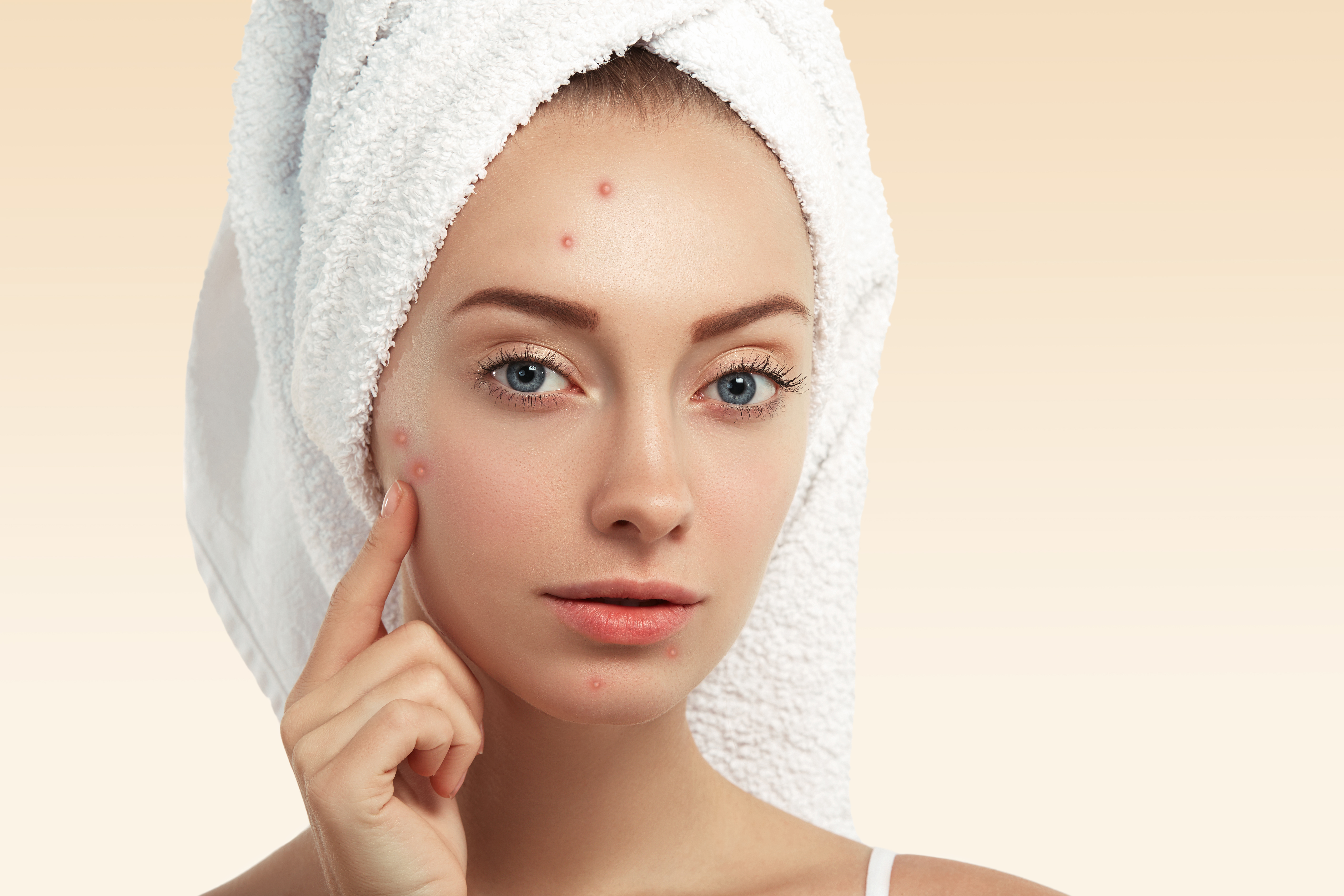 Wondering why acne keeps coming back after treatment? Learn the real causes of recurring acne, effective treatment options, and prevention tips from the dermatologists at RS Skin & Hair Clinic, Delhi.