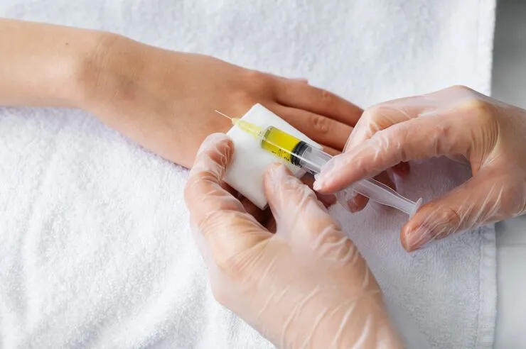 Advanced Platelet Rich Plasma Therapy at RS Skincare